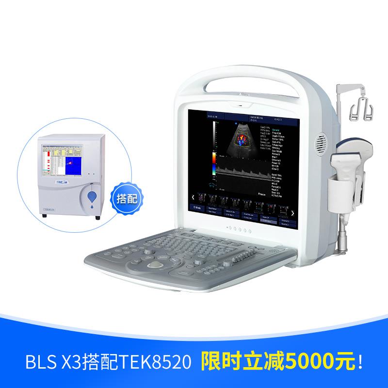 贝尔斯全数字彩色多普勒超声系统BLS-X3